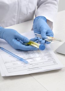 Profissional da saúde segurando amostra de urina para Exame Toxicológico para Renovação de CNH