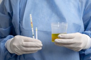 Profissional da saúde segurando amostra de urina para exame toxicológico para CNH